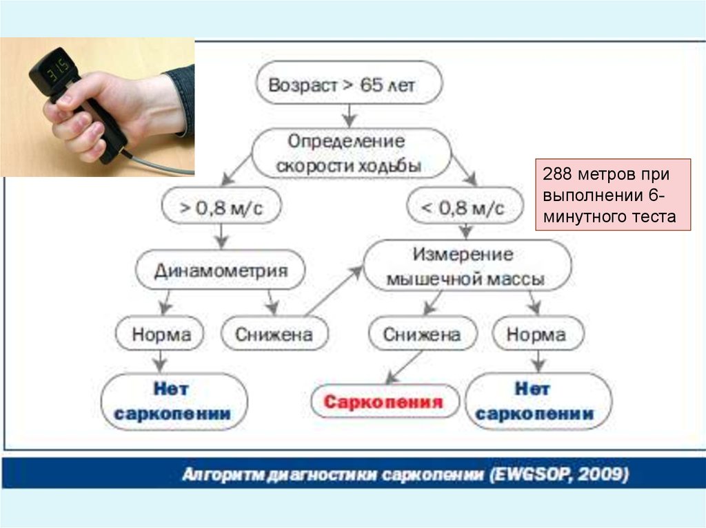 Саркопения что это такое симптомы лечение у женщин препараты схема лечения