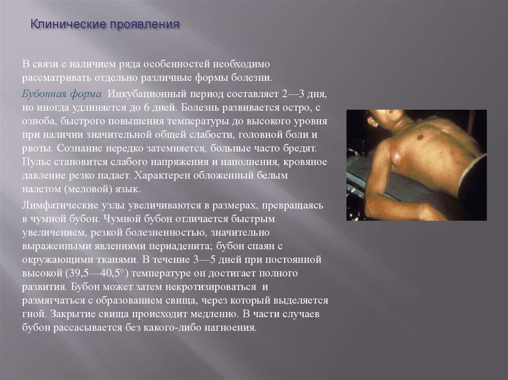 Клинические проявления