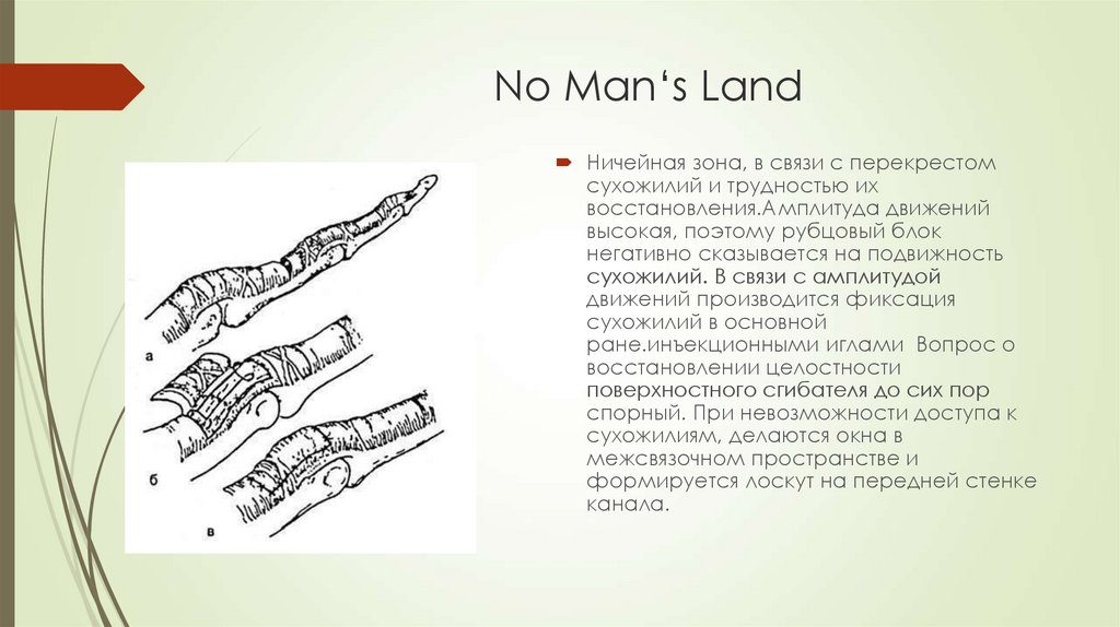No Man‘s Land