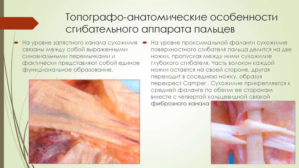 Топографо-анатомические особенности сгибательного аппарата пальцев
