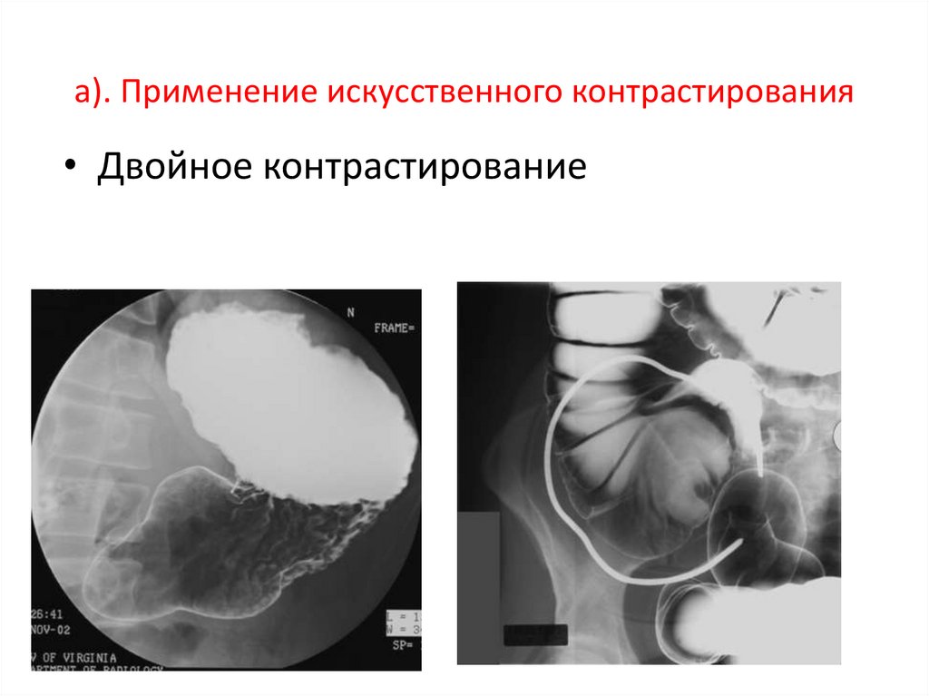 Методы контрастирования изображения