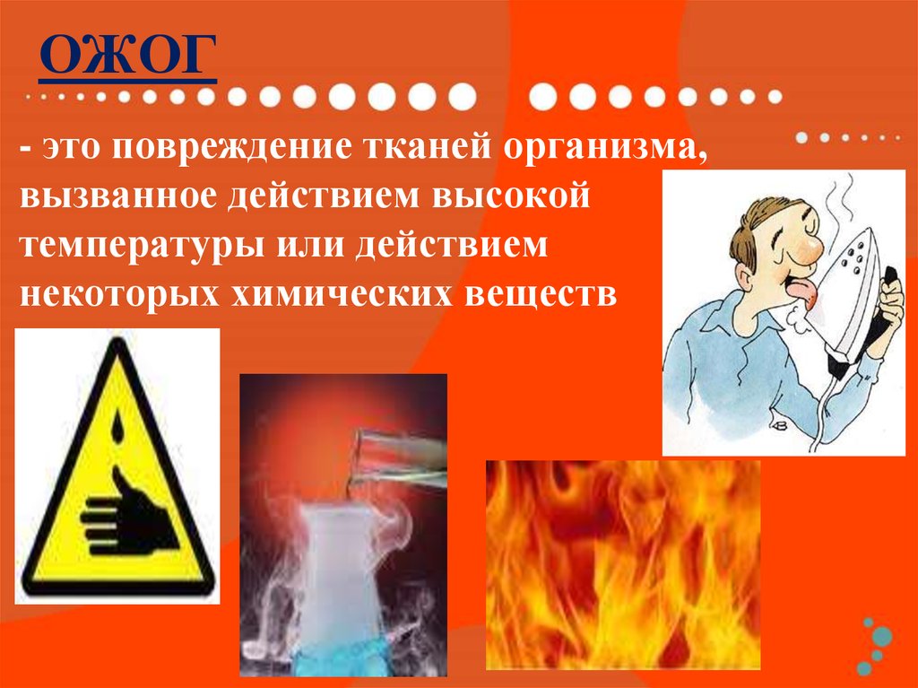 Опасными для жизни ожогами являются. Травма химический ожог. Термические и электрические ожоги. Химические ожоги презентация.