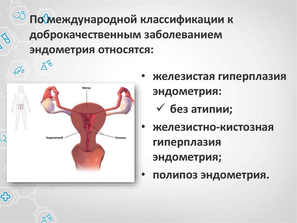 Фоновые заболевания эндометрия презентация