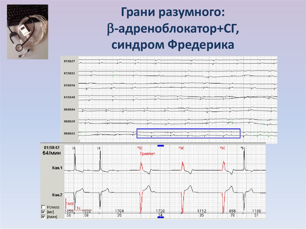 Пароксизмальная форма фп карта вызова