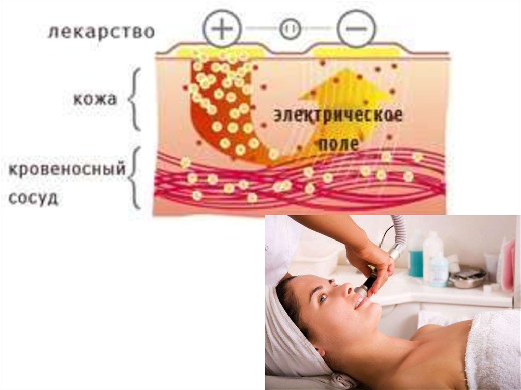 Лекарственный электрофорез презентация