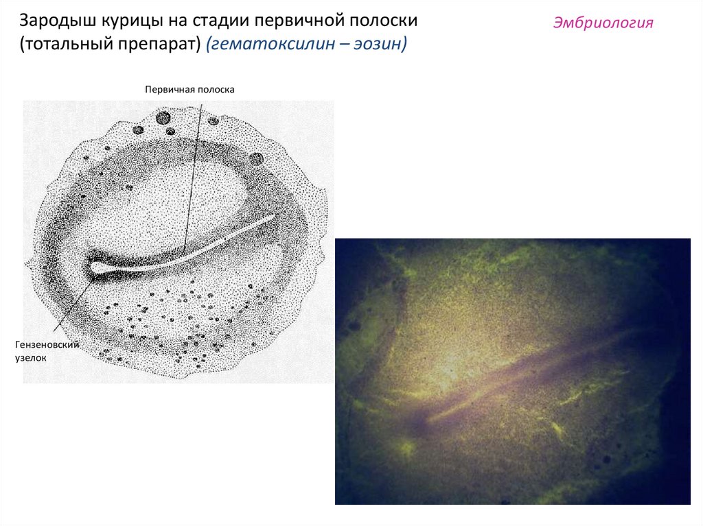 Первичный узелок. Первичная полоска зародыша курицы Тотальный препарат. Первичная полоска зародыша курицы гематоксилин. Первичная полоска гистология препарат. Первичная полоска Тотальный препарат зародышевого диска.