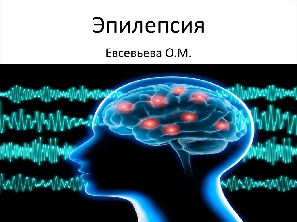 Эпилепсия нервной системы. Эпилепсия презентация. Эпилепсия презентация по неврологии.