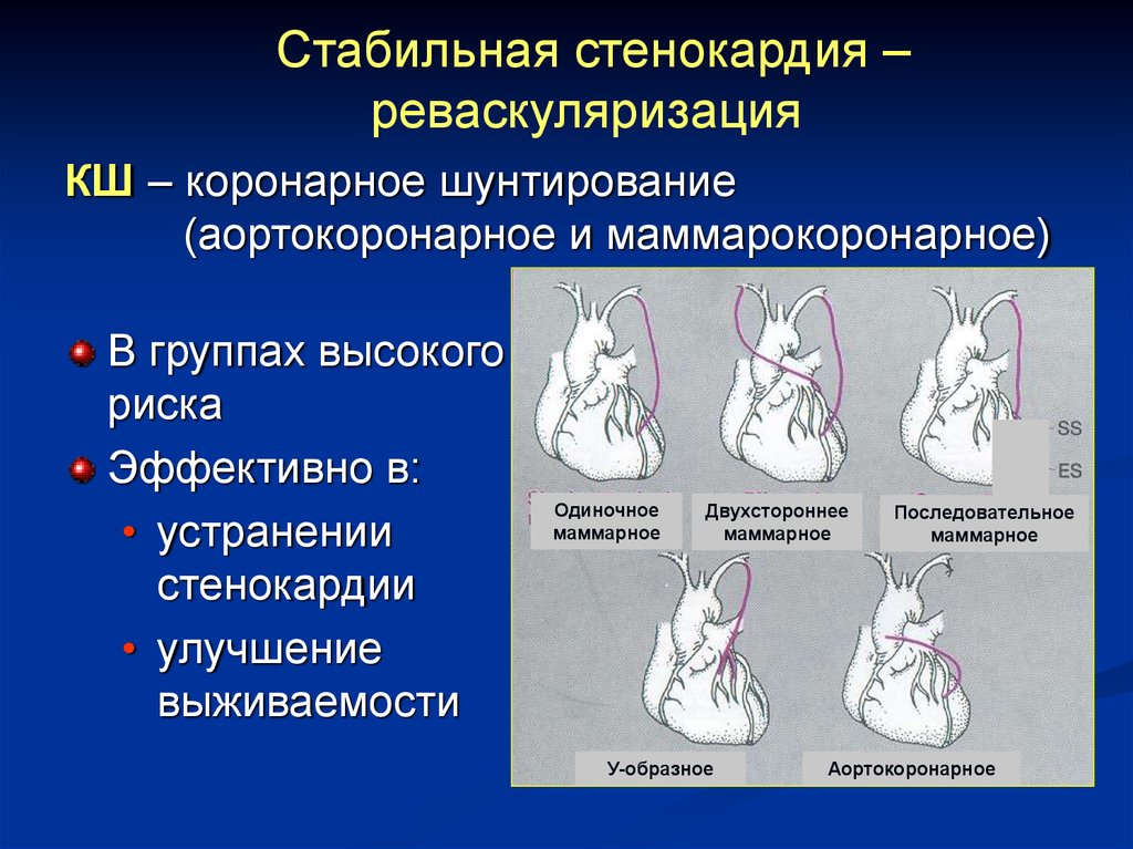 Стабильная стенокардия презентация