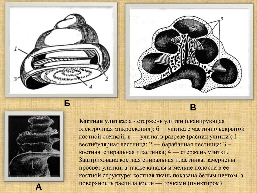 Стенки улитки