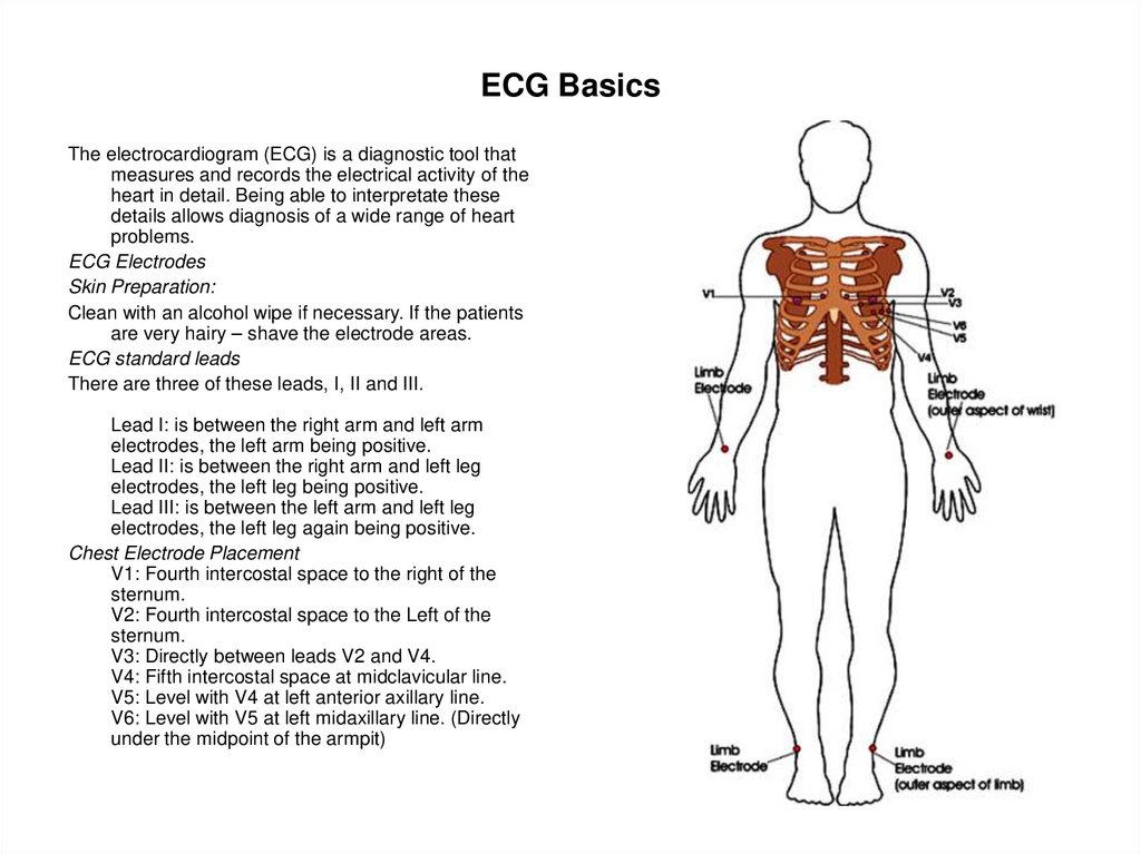 ECG Basics
