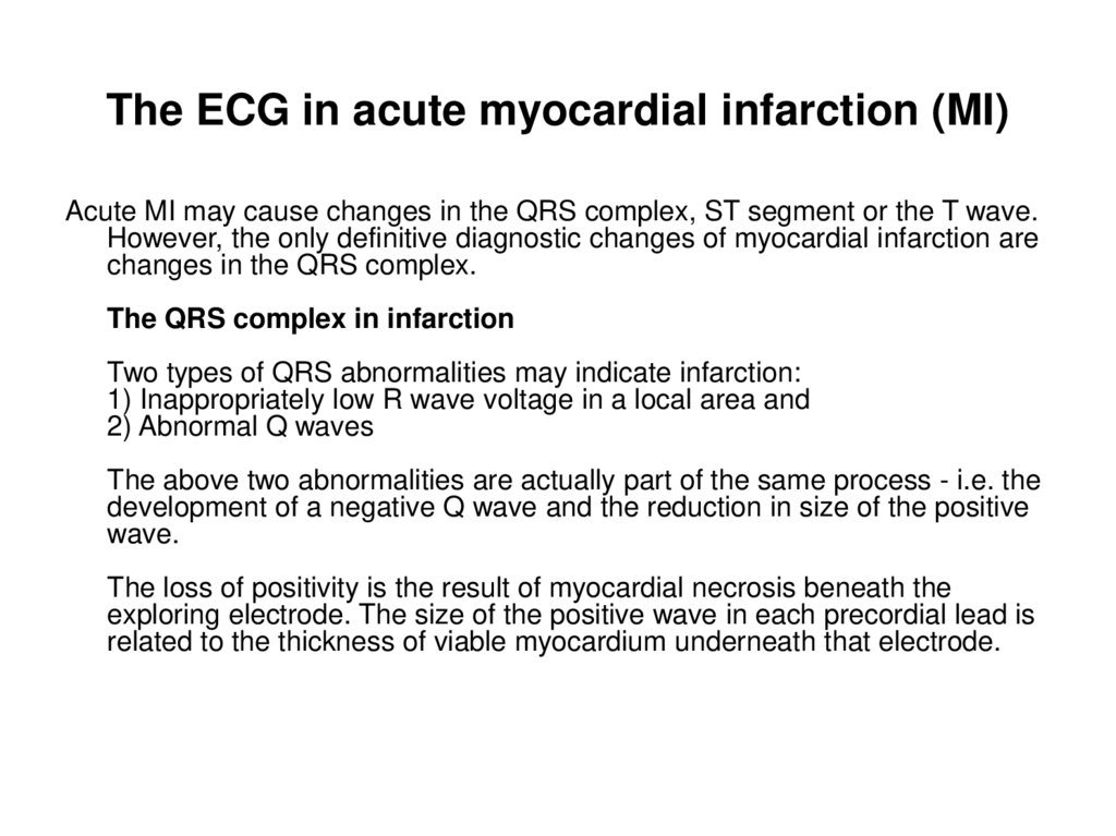 The ECG in acute myocardial infarction (MI)