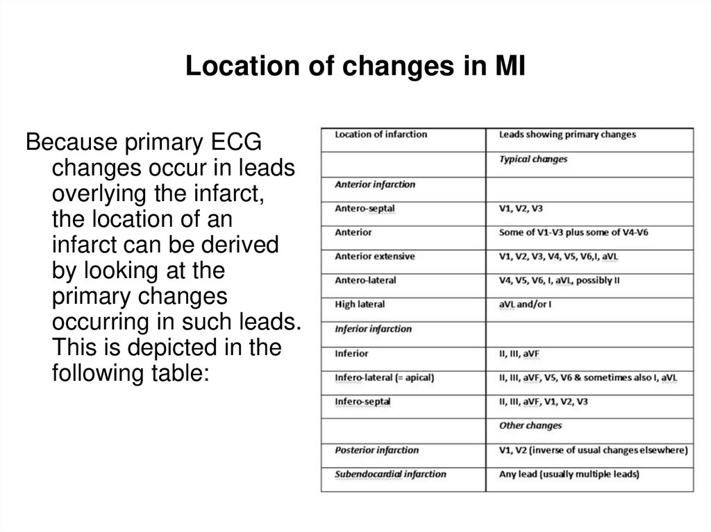 Location of changes in MI