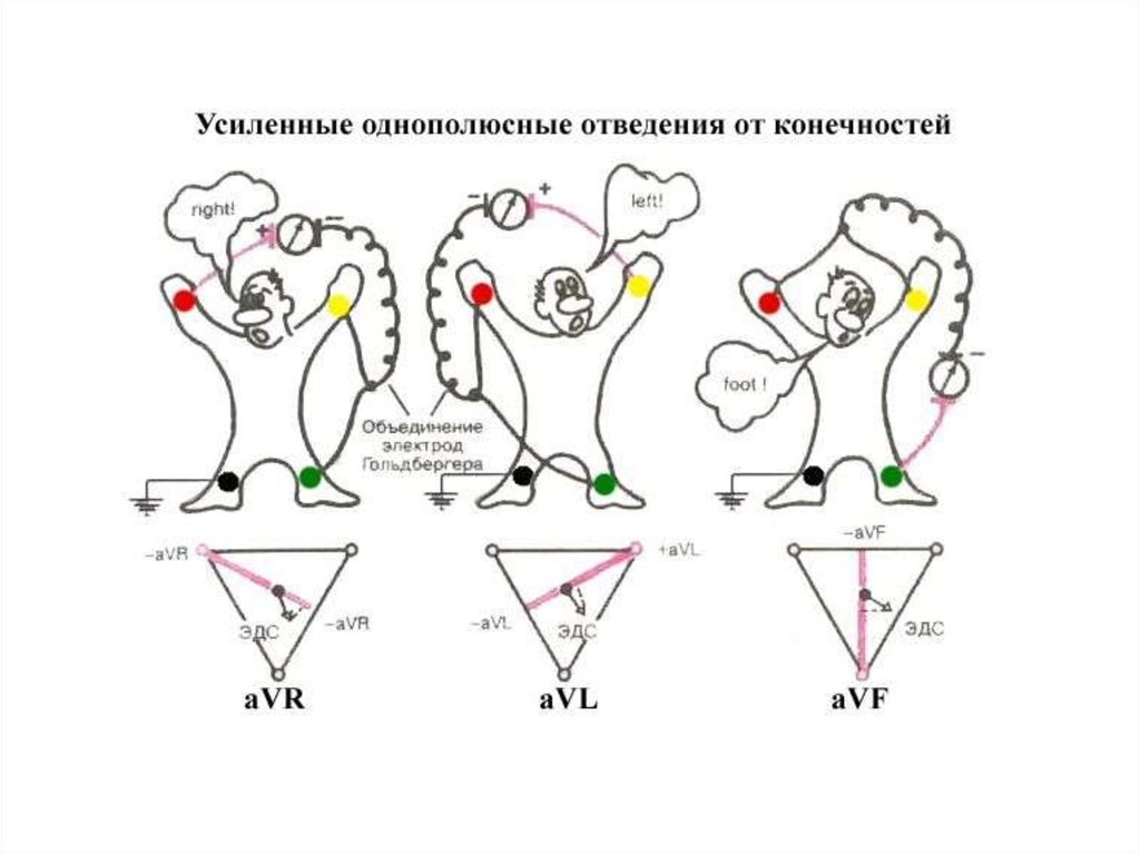 12 отведений экг схема