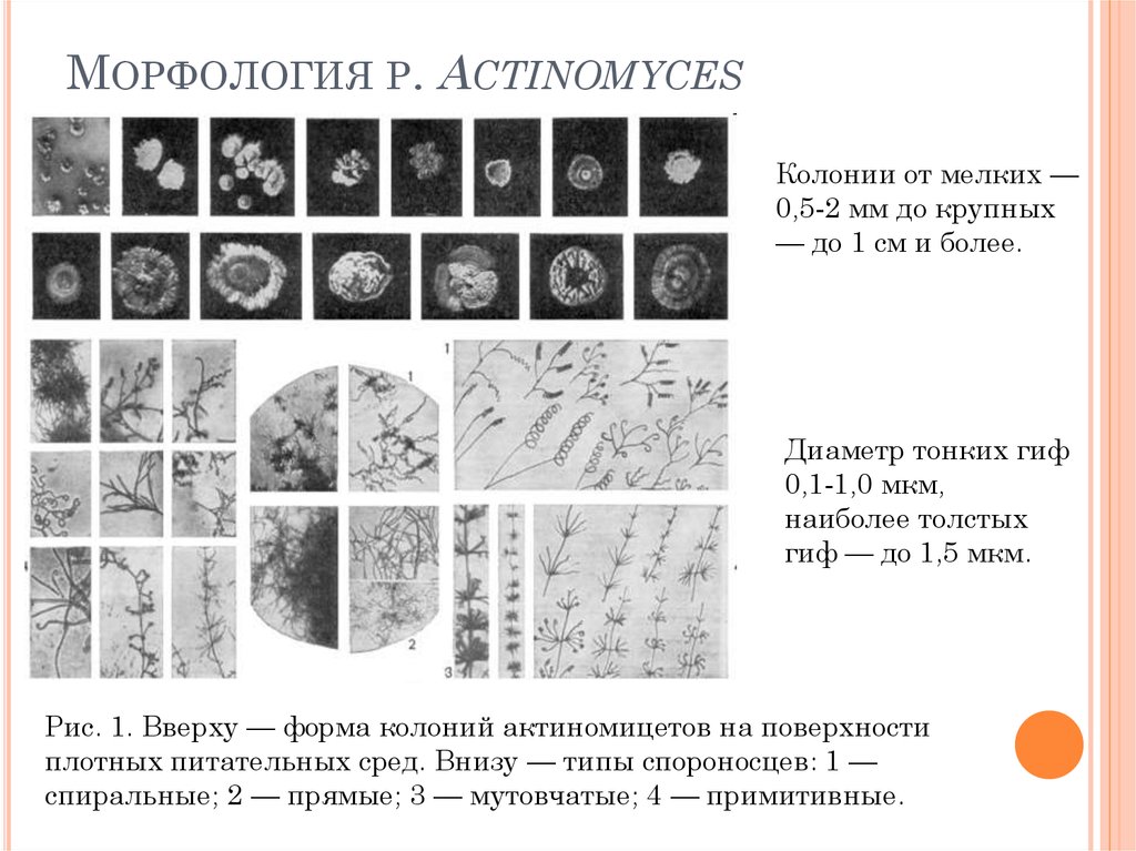 Формы колоний. Морфология колоний актиномицетов. Морфология колоний форма. Строение колонии актиномицет.