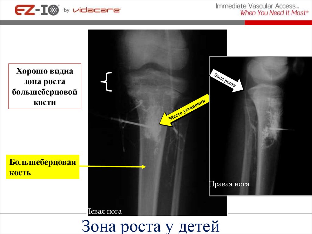 Зона роста