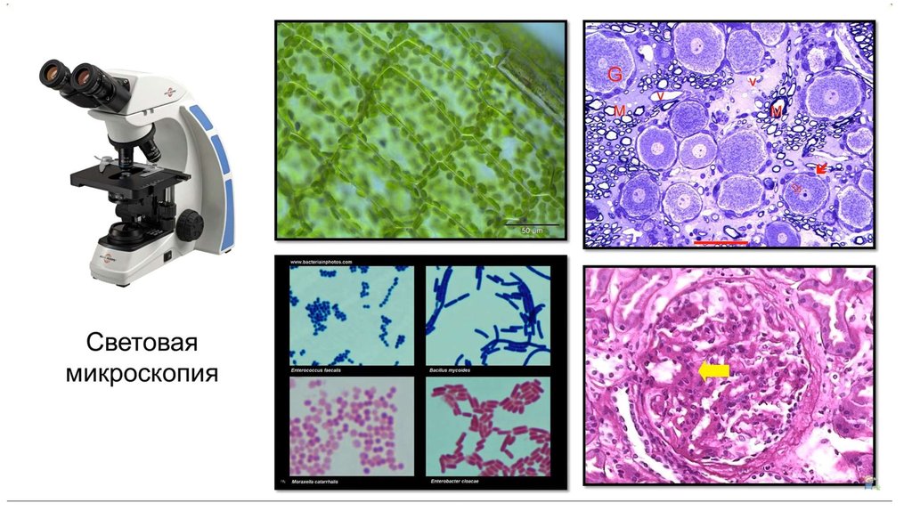 Какой микроскоп можно увидеть. Световая микроскопия это в гистологии. Световая микроскопия растительных клеток. Световая оптическая микроскопия метод. Световой микроскоп гистология.