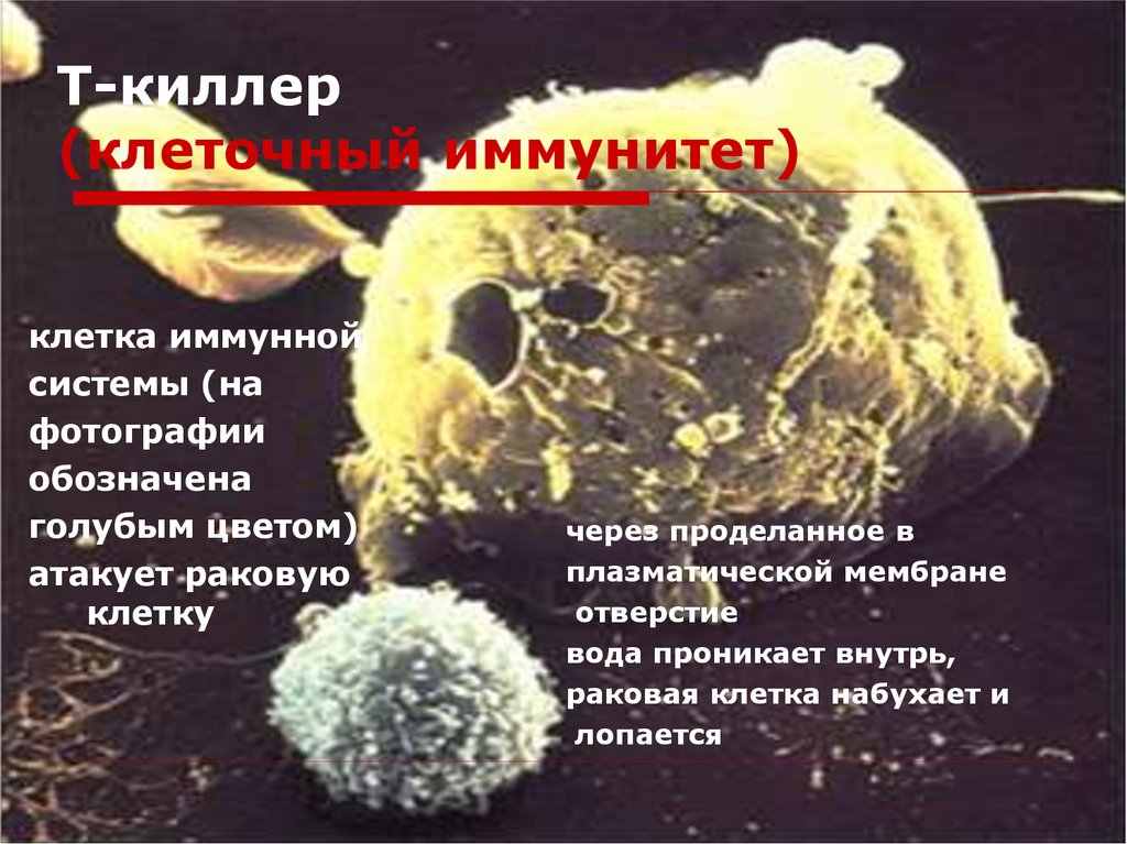 T killer. Т лимфоциты киллеры. Клетки иммунной системы т-киллеры. Клеточный иммунитет т киллеры. Т киллеры иммунология.