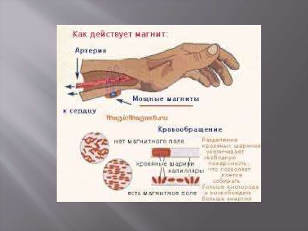 Магнитотерапия картинки для презентации