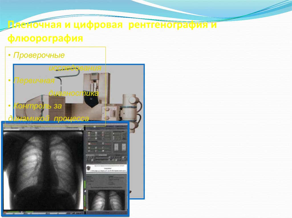 Лучевая диагностика хобл презентация