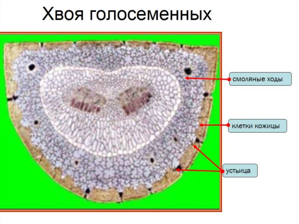 Клетки хвойных. Поперечный срез листа сосны под микроскопом. Строение хвоинки сосны под микроскопом. Поперечный разрез хвоинки сосны. Поперечный срез листа сосны смоляные ходы.
