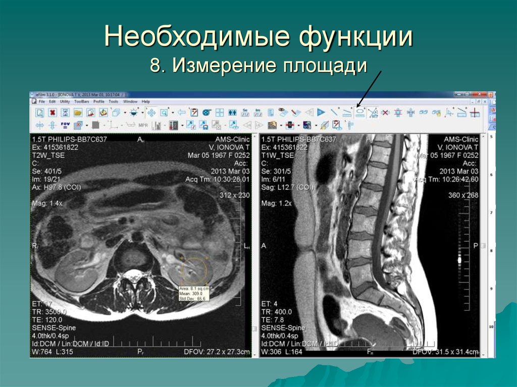 Магнитно резонансная томография презентация