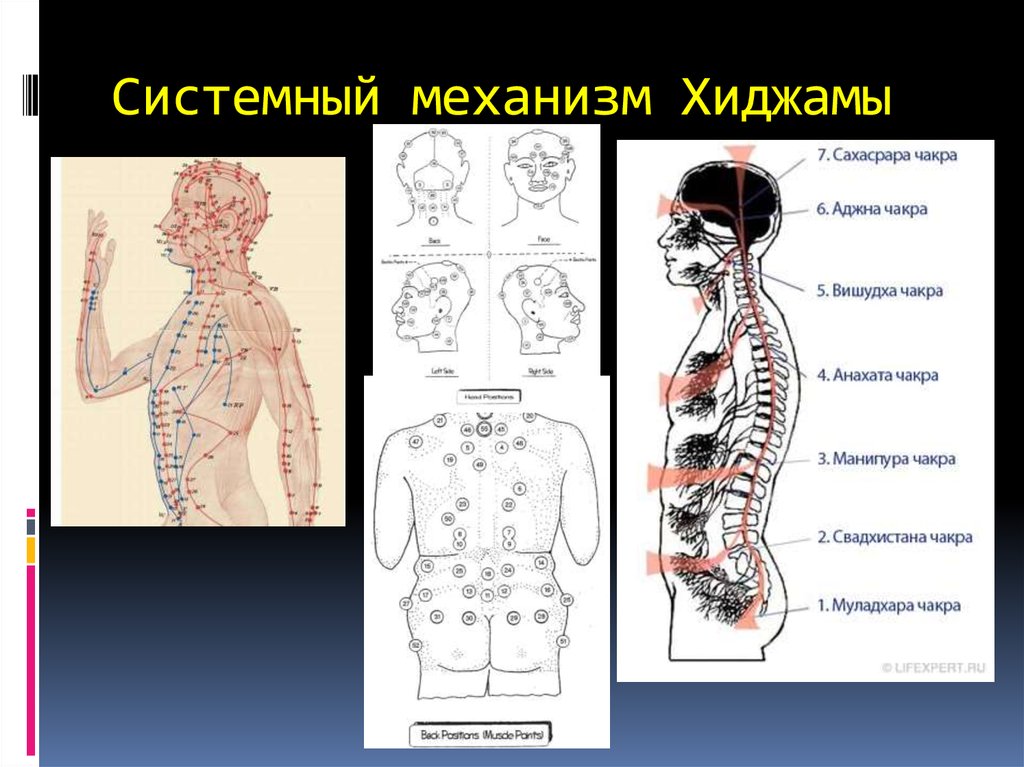 Атлас точек для хиджамы с описанием схемами