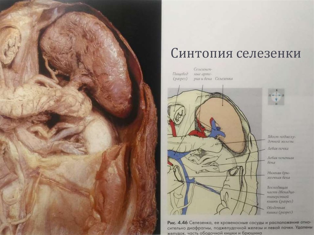 Синтопия селезенки