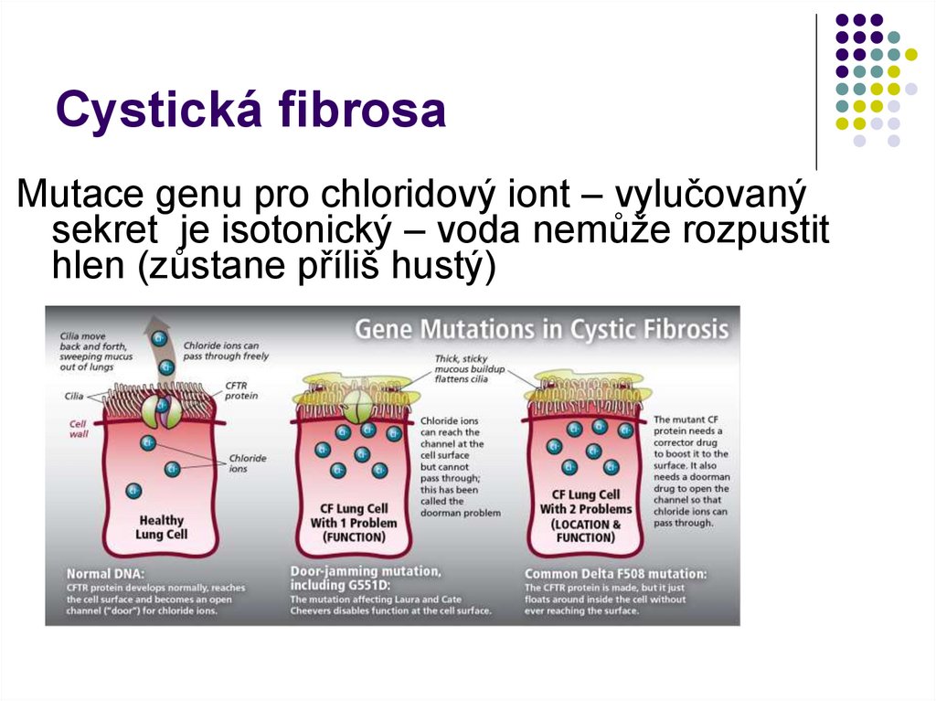 Cystická fibrosa