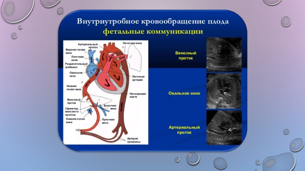 Кровообращение у плода презентация