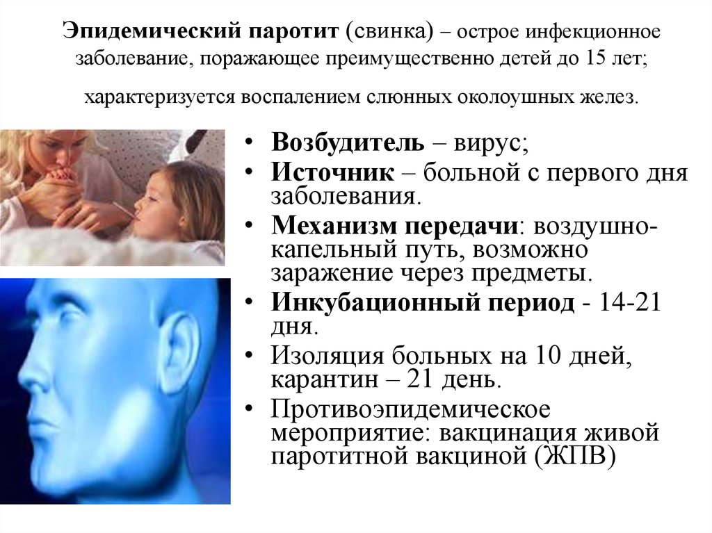 Свинка лечение. Эпидемический паротит путь инфицирования. Паротит заболевание профилактика. Признаки эпидемического паротита. Эпидемический паротит клиника периоды.