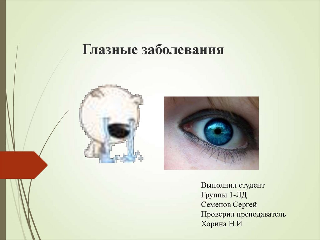 5 заболеваний глаз. Презентация на тему глазные заболевания. Плакат глазные болезни.