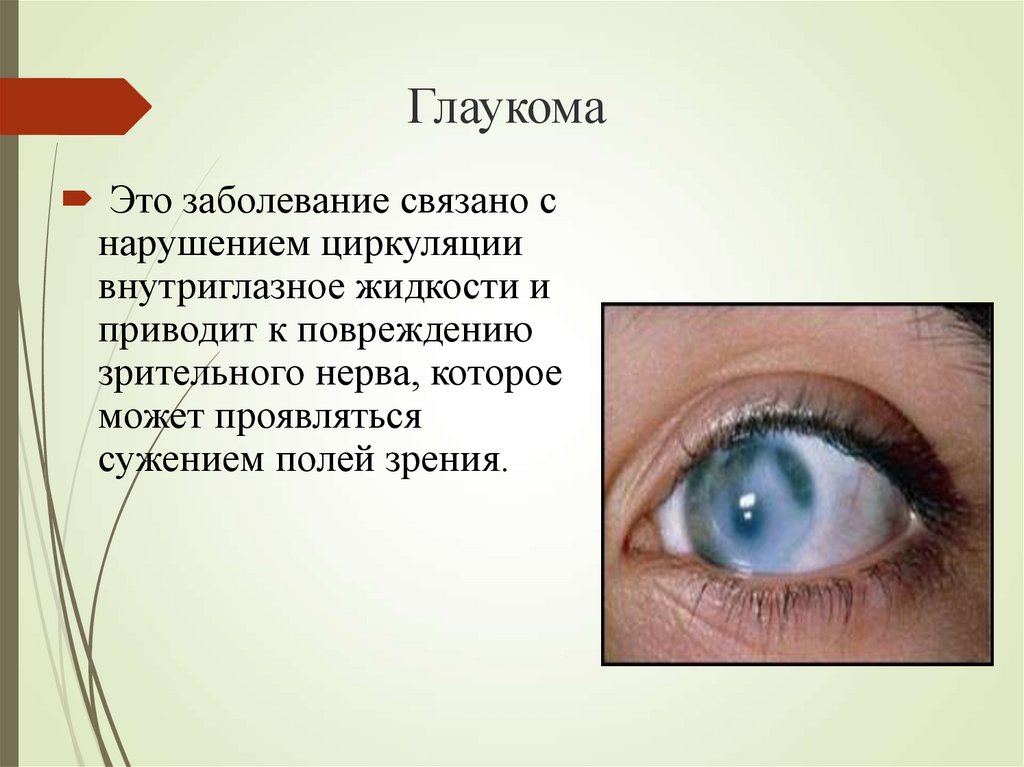 Глаза признак. Презентация болезни глаз. Заболевание глаз глаукома. Глазные заболевания презентация.