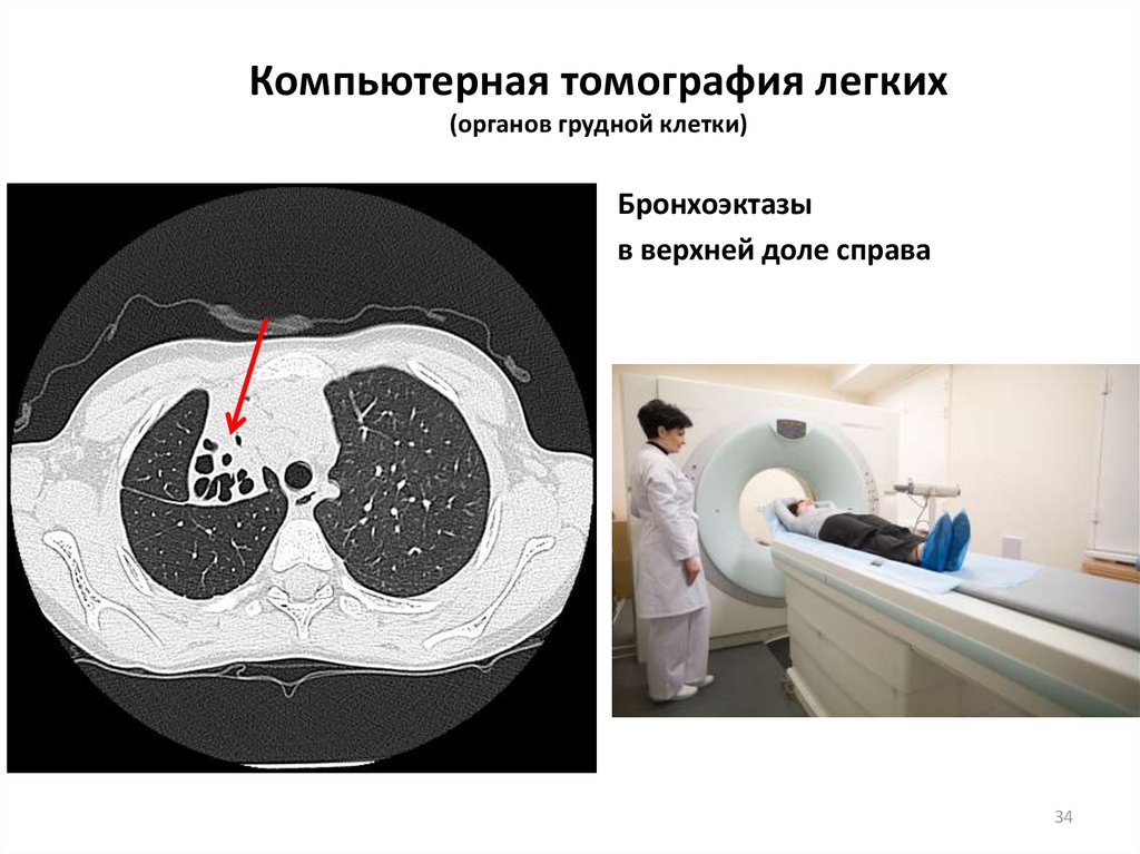 Презентация кт легких