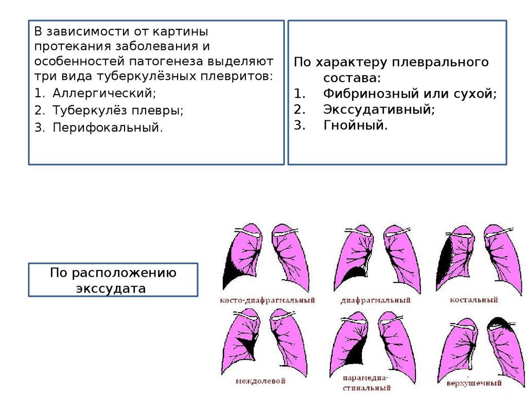 Для клинической картины плеврита характерно все кроме тест