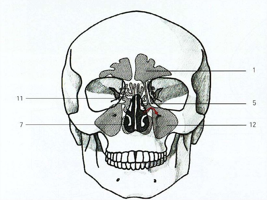 Проекция носа. Околоносовые придаточные пазухи. Придаточные пазухи носа анатомия. Воздухоносные пазухи черепа анатомия. Воздухоносные придаточные пазухи носа.