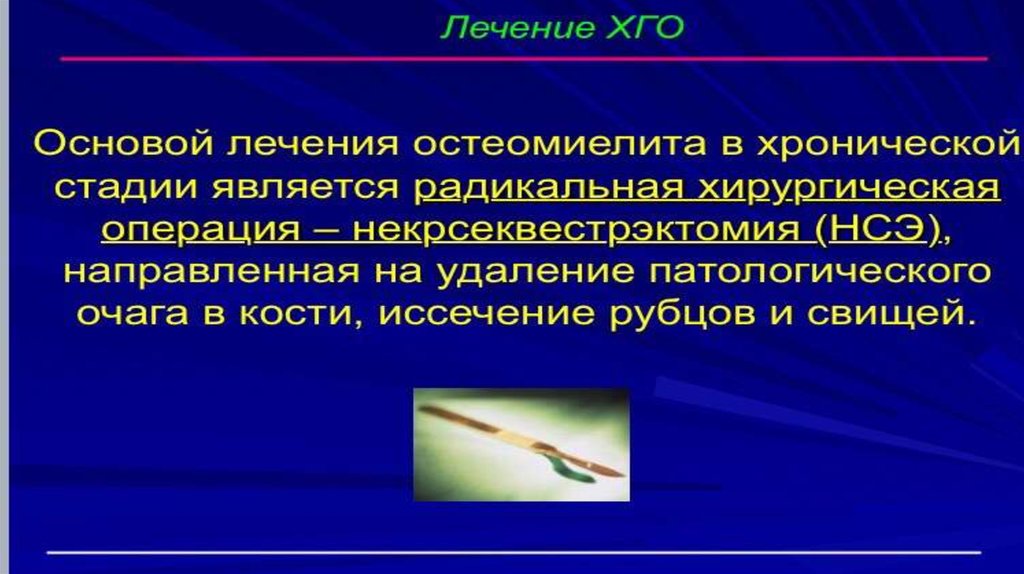 Острый гематогенный остеомиелит диагностика. Острый гематогенный остеомиелит сцинтиграфия.