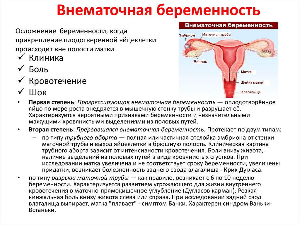 Тянет внизу живота матка. Если внематочная беременность. Матка внематочная беременность. Беременность в маточной трубе. Осложнения внематочной беременности.