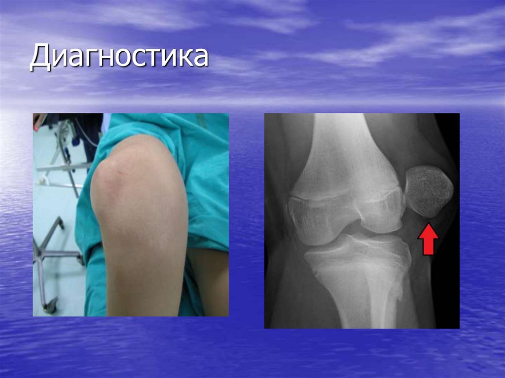 Диагностика