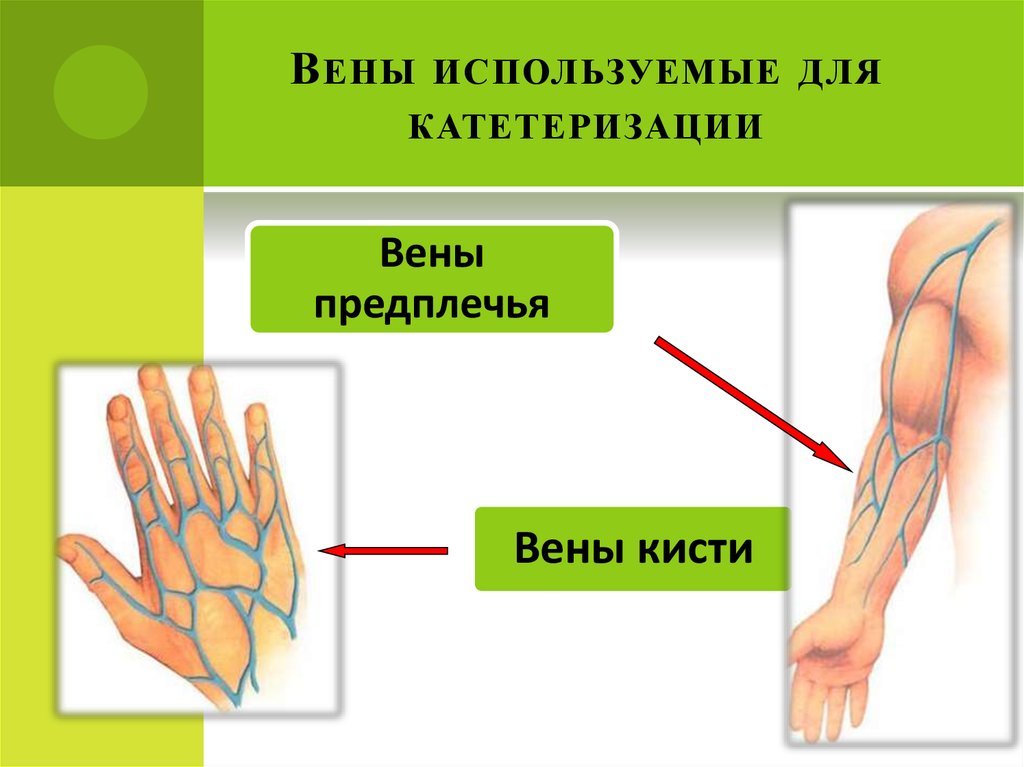 Установить вена. Вены предплечья для катетеризации. Периферическая Вена на руке.