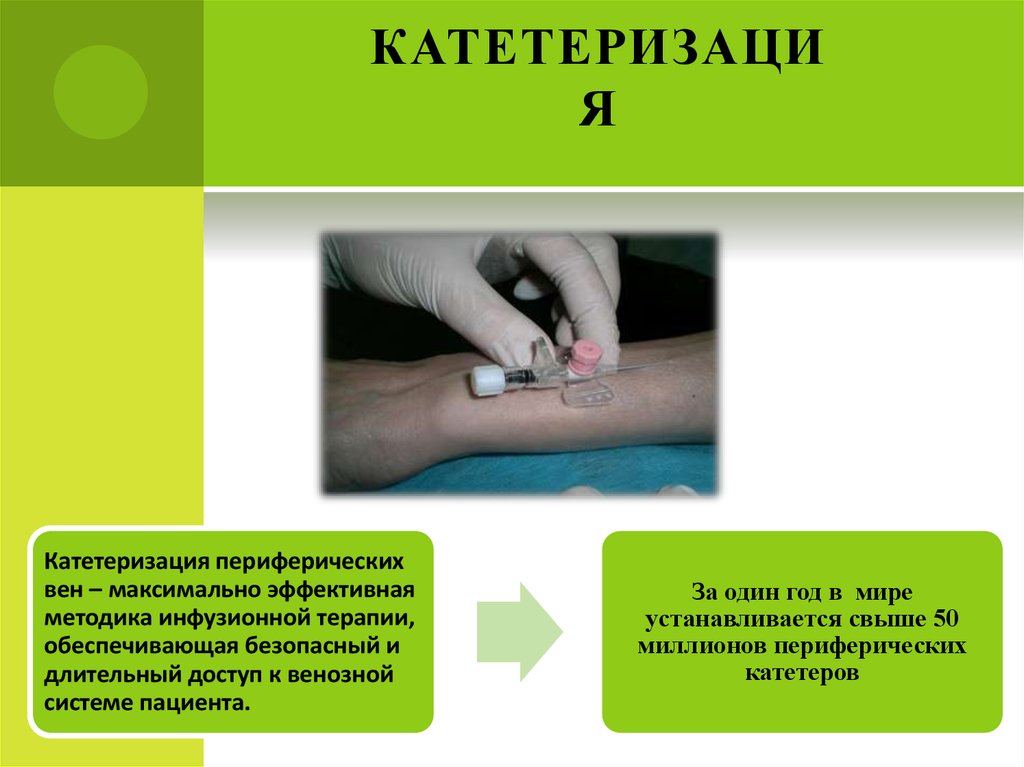 Введение периферического венозного катетера. Катетеризация периферических вен. Постановка периферического катетера. Катетеризация вены алгоритм. Методика выполнения катетеризации периферических вен.