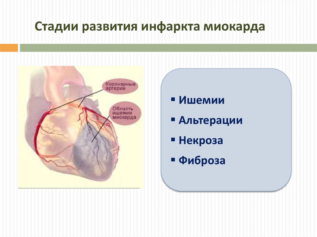 Стадии инфаркта миокарда. Этапы развития инфаркта миокарда. Вокруг очага инфаркта миокарда развивается. Стадияраазвития инфаркта миокарда.