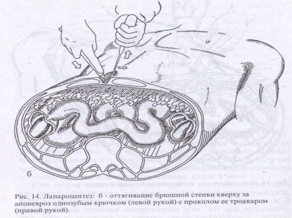 Открытые травмы живота картинки