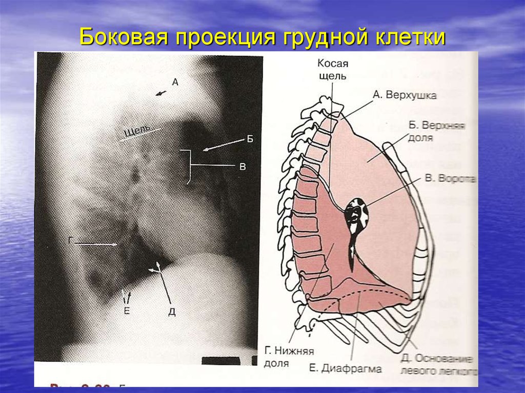 Проекции грудной клетки. Боковая проекция органов грудной клетки. Проекция органов на грудную клетку. Боковая проекция грудины. Грудина косая проекция.