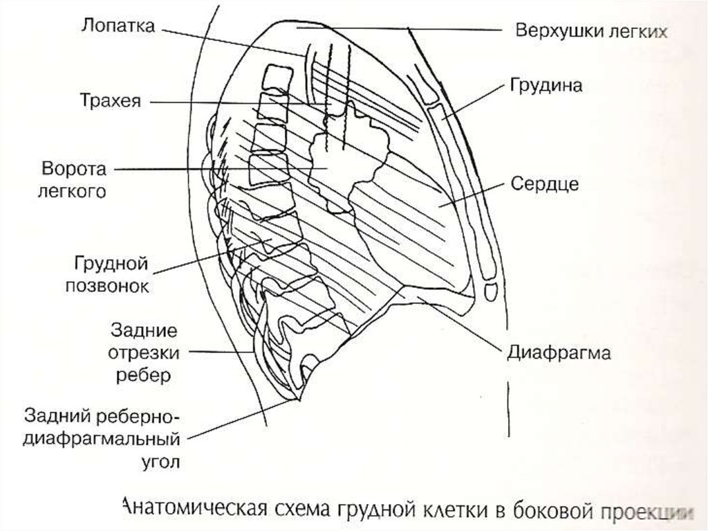 Рахитическая грудная клетка рисунок схематично