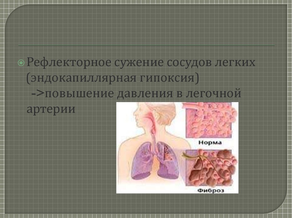 Синдром хаммена рича презентация у детей