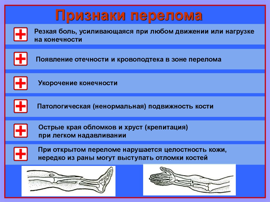 Если при открытом переломе имеется повреждение артерии. Симптомы при переломе костей конечностей. Признаки при переломе конечностей. Оказание первой доврачебной помощи при переломах костей конечностей. Симптомы повреждения костей конечностей.