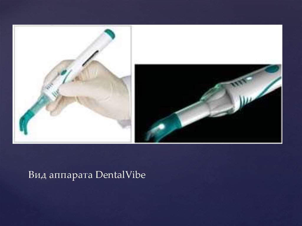 Вид аппарата DentalVibe