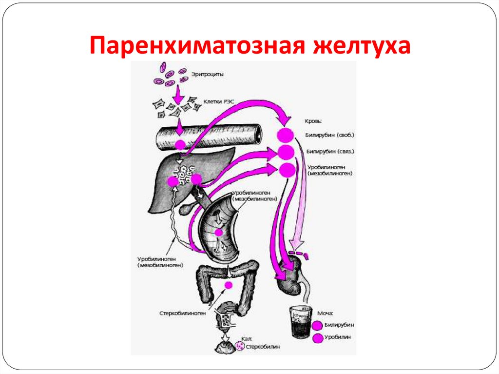 Механическая желтуха