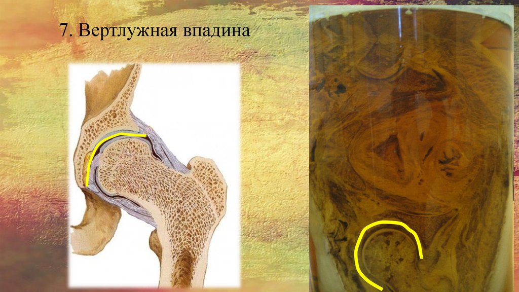 7. Вертлужная впадина