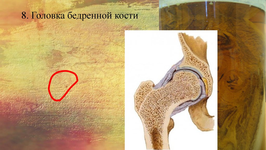 8. Головка бедренной кости
